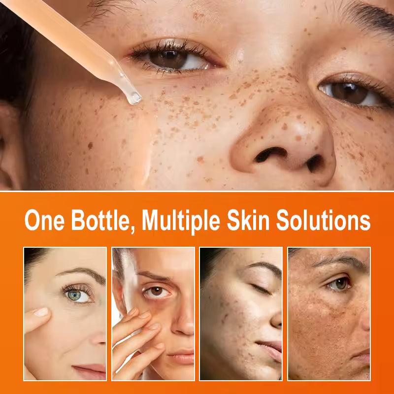 Complete Skin Transformation Kit – 4 Professional Serums for Brightening, Anti-Aging, and Hydration